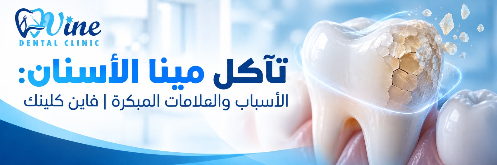تآكل مينا الأسنان: الأسباب والعلامات المبكرة | فاين كلينك 
