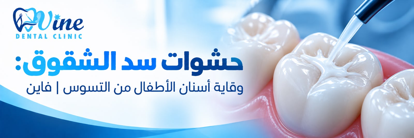  حشوات سد الشقوق: وقاية أسنان الأطفال من التسوس | فاين